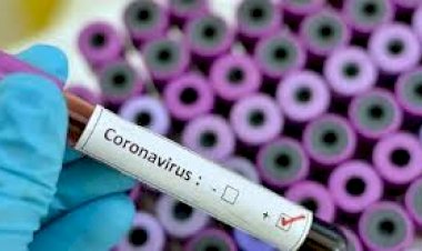 عَزْل المدن التركية يكشف فَشَل حكومة 