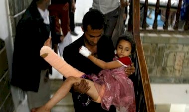 في 7 سنوات.. كيف حوَّل الحوثيون اليمن من مركز العرب إلى أفقر دول المنطقة؟