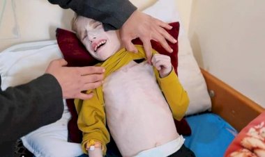 انقذوا فادي الزنط.. طفل مهدد بفقدان حياته نتيجة سوء التغذية والجفاف في غزة.. ما القصة؟