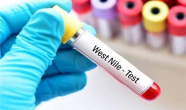 بعد انتشاره في إسرائيل وتسببه في مقتل العشرات.. مصر تتخذ خطوات صارمة لمنع دخول فيروس خطير