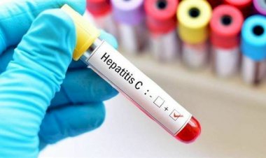 التصنيف الذهبي.. مصر تتصدر العالم في مكافحة التهاب الكبد C