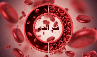 الأنيميا.. مرض صامت يهدد الصحة.. إليك طرق التعامل معه