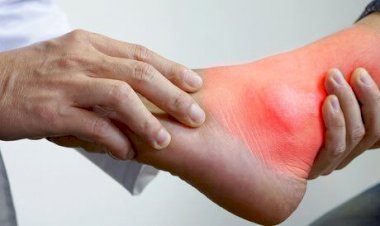 تعرف على علاج النقرس وأعراضه وطرق الوقاية منه