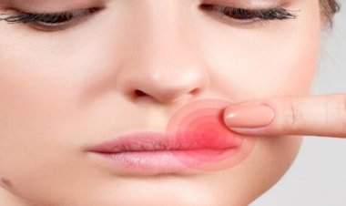 تعرف على أضرار الحبوب حول الفم