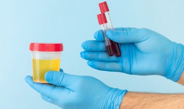 تعرف على علاج زلال البول