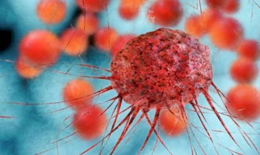 الفرق بين الورم الخبيث والورم الحميد