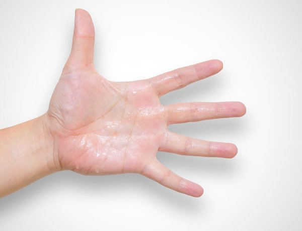 تقرير حول علاج التعرق الزائد في اليدين والقدمين