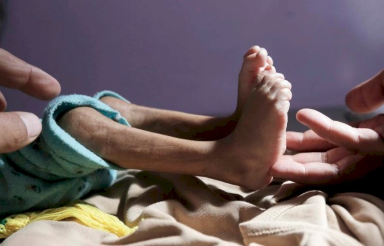 العيد حزين في اليمن.. فرحة تغيب تحت أنقاض الجوع