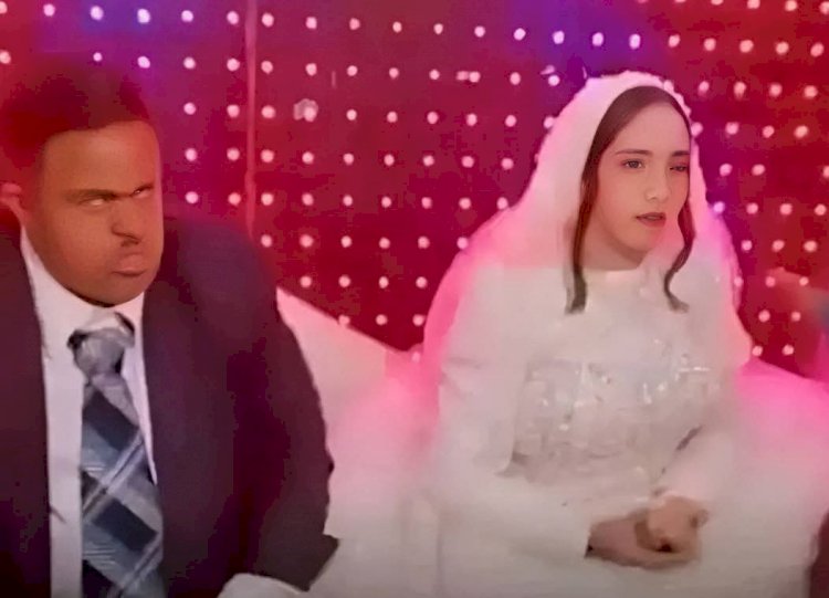 عريس متلازمة داون.. تفاصيل حفل الزفاف المثير للجدل