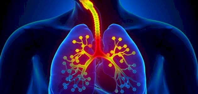 تقرير طبي: التهاب القصبات الهوائية