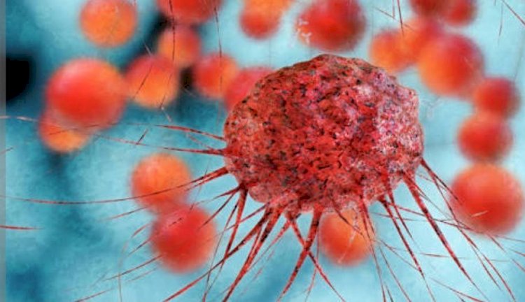 الفرق بين الورم الخبيث والورم الحميد